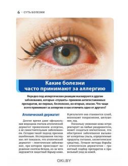 Аллергия под контролем 3 / 2021 Коллекция «Доброго здоровья»